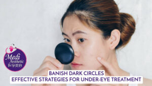 Banish Dark Circles Effective Strategies For Under-Eye Treatment Malaysia